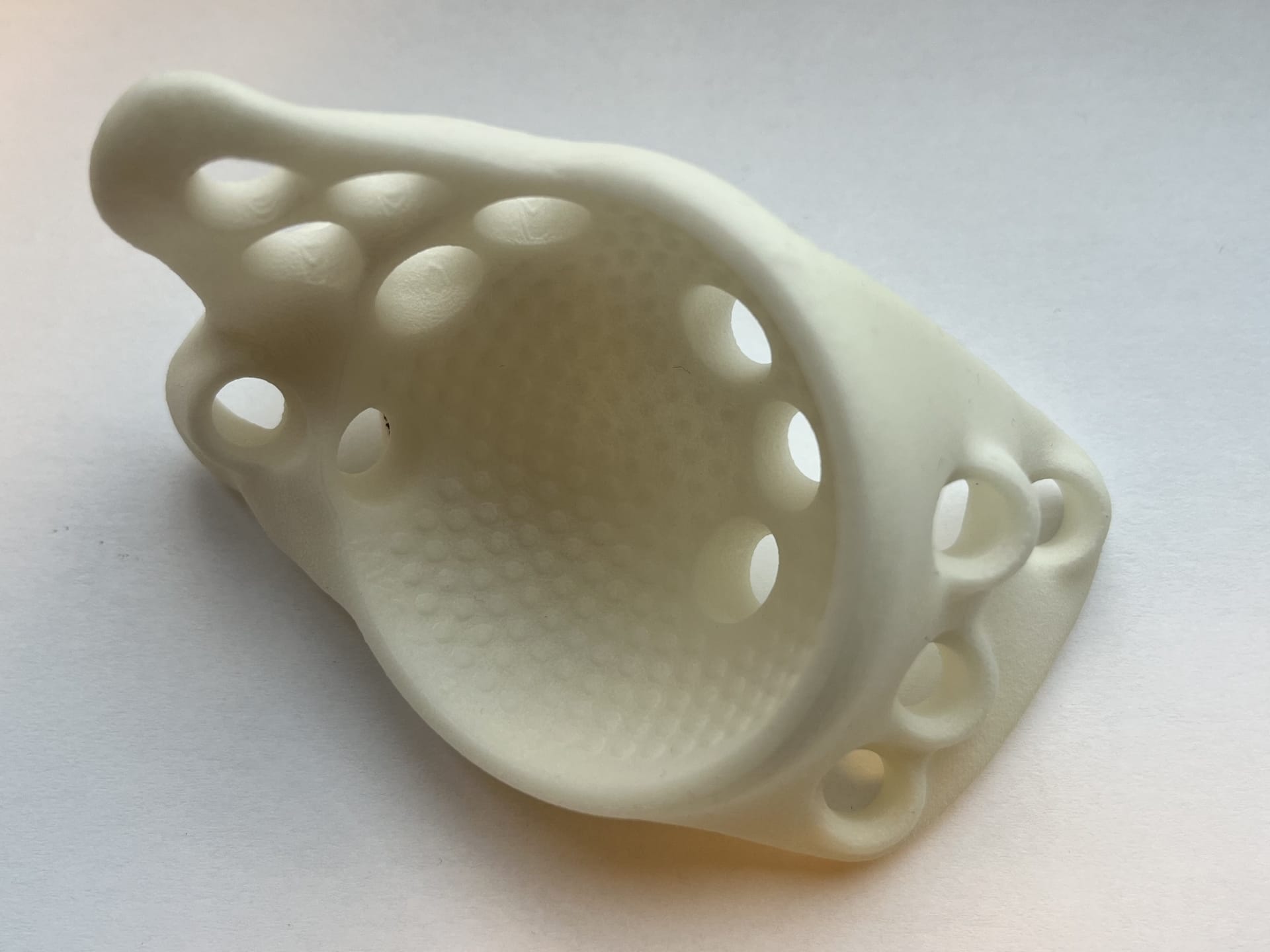 3d-geprinte heupprothese